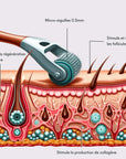The 540: Magic-Boost Dermaroller 0.5 mm