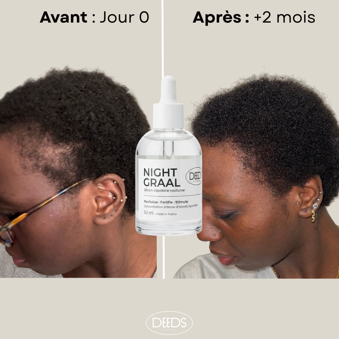 Sérum Night Graal - Anti-chute et stimulation de la pousse