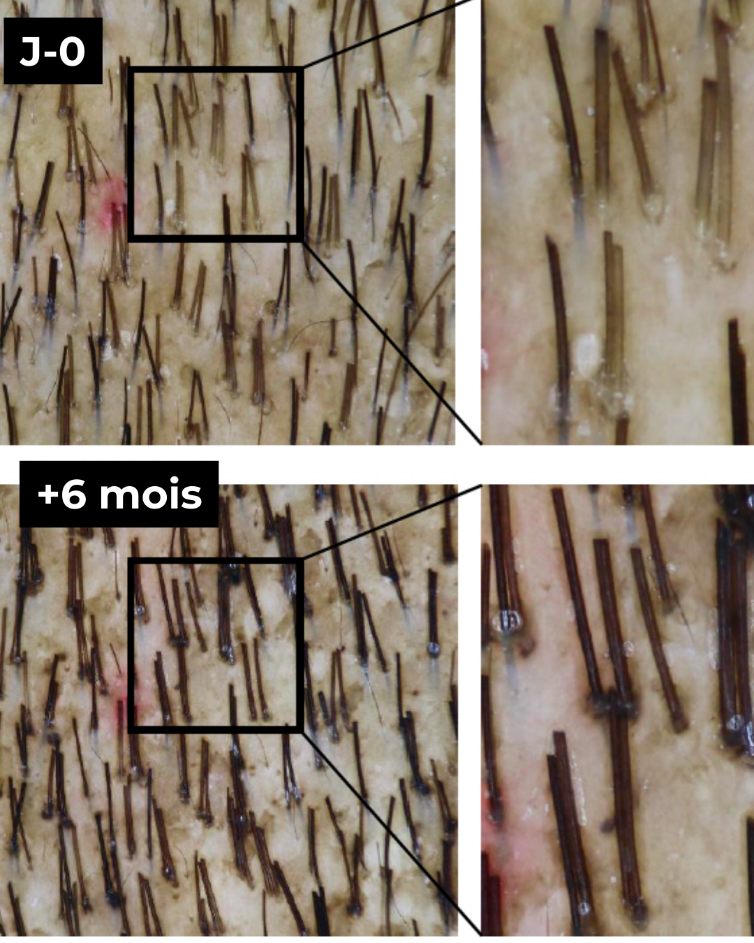 Sérum Night Graal - Anti-chute et stimulation de la pousse