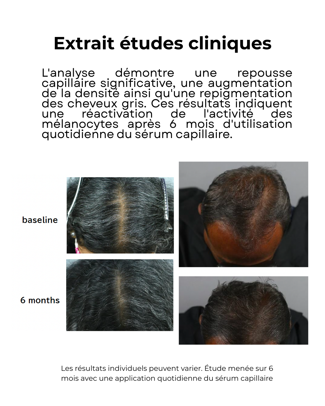 Sérum Night Graal - Anti-chute et stimulation de la pousse