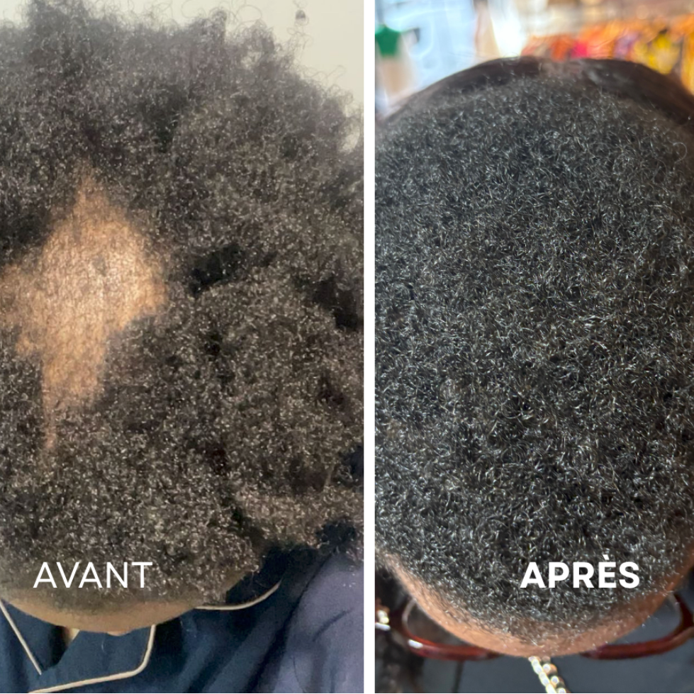 Diagnostic capillaire personnalisé — 1h